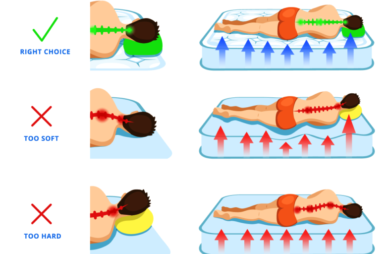 Good mattress can prevent back pain by providing good sleeping posture